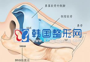 韩国鼻尖整形手术的方法论述