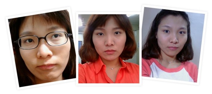 去韩国改脸型整容经历分享
