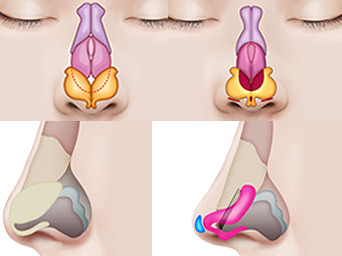 鼻子结构