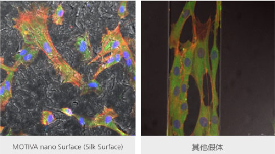 MOTIVA nano Surface (Silk Surface)和其他假体
