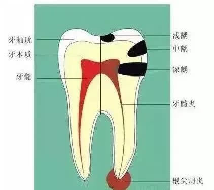 牙齿结构图.jpg