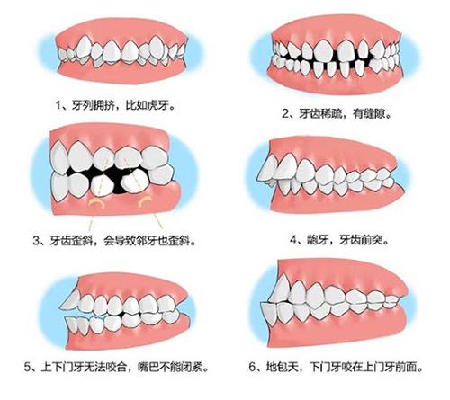 各类牙齿口腔问题