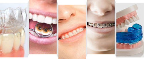 牙齿矫正的不同方法