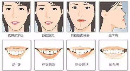 牙齿矫正能够改善的问题