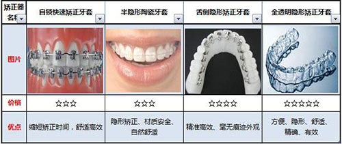 各牙齿矫正方式的价格和优势