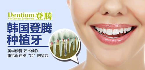 韩国登腾种植牙品牌