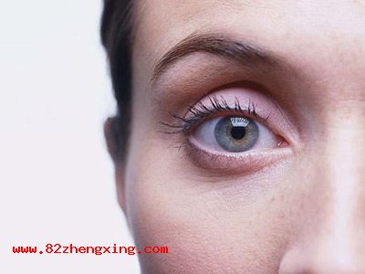 埋线双眼皮手术有哪些适应症