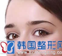 韩式双眼皮，带你进入大眼睛王国