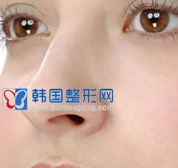 男性隆鼻选择假体隆鼻好不好？