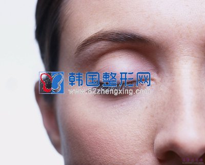 埋线法PK开切法
