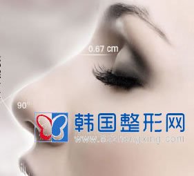 鼻翼缩小术的方法介绍