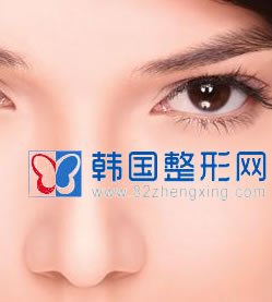假体隆鼻效果可以保持多久？