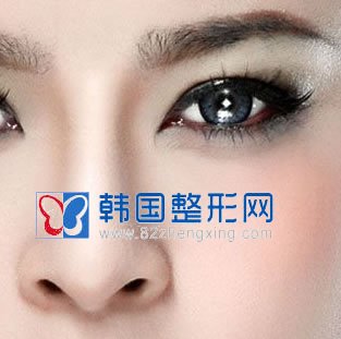 导致假体隆鼻失败的原因有哪些？
