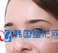 祛眼袋后如何护理？