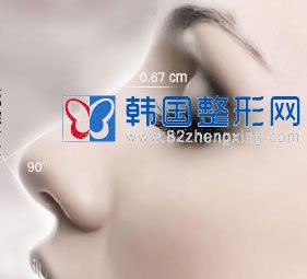 假体隆鼻的价格主要受哪些因素影响？