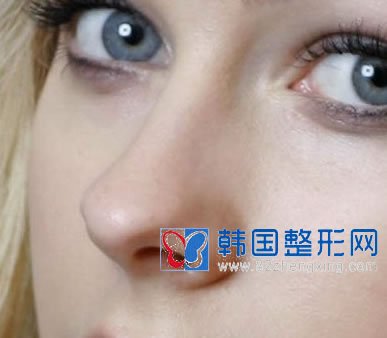 隆鼻，让你瞬间征服世人