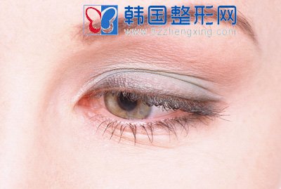 上睑下垂的矫正方法