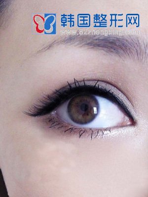 如何治疗后日性上睑下垂