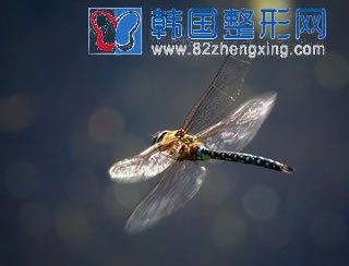 面部除皱术后恢复要多久？