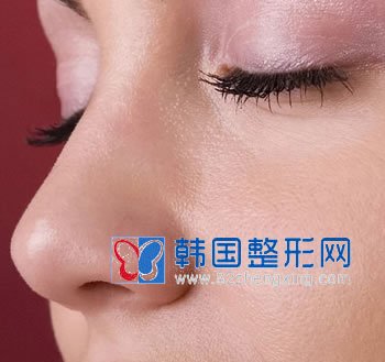 鹰钩鼻应矫正 让鼻子呈现完美状态