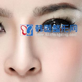 鼻尖整形矫正蒜头鼻的效果如何？
