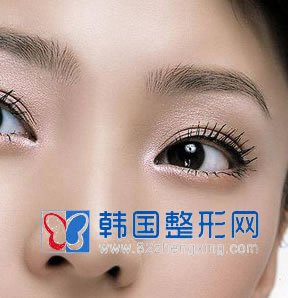 鼻尖抬高手术注意事项论述