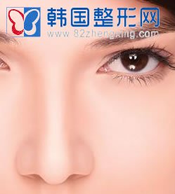 鼻头缩小术手术之前要注意什么？