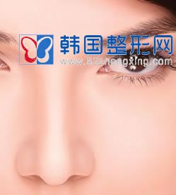 低鼻尖矫正手术方法有哪些？