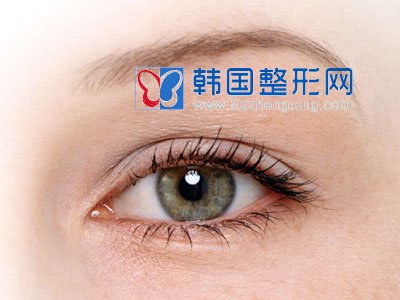 三点定位双眼皮如何做好术前筹备？