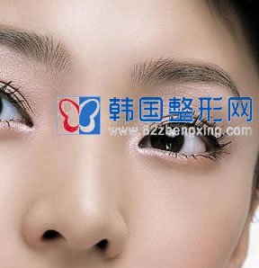 鼻尖整形术后饮食需要注意些什么？