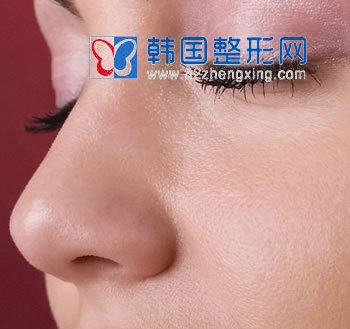 圆钝鼻尖怎么整形