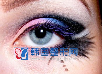 埋线双眼皮手术效果保持长短因人而异