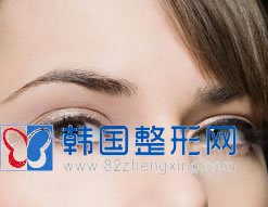 解密高分子双眼皮手术