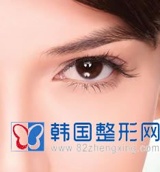 高分子压双眼皮手术优势