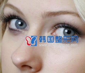 内双能做双眼皮手术吗