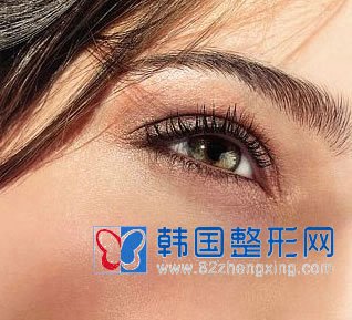 三点定位双眼皮手术效果如何