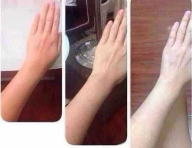 美白针效果对比