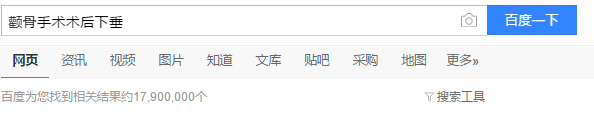 颧骨内推术后下垂搜索.png
