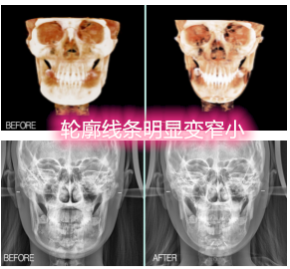 菲斯莱茵.png