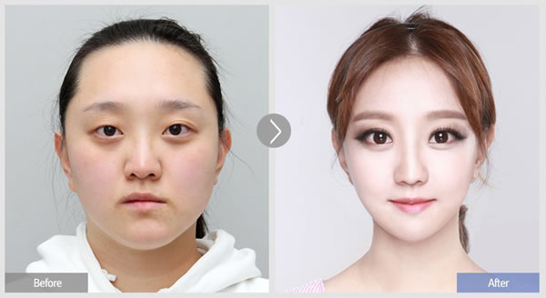 菲斯莱茵芭比娃娃眼型调整图片.jpg