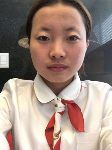眼鼻综合整形过程