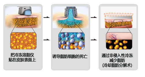 20150818060709995.jpg