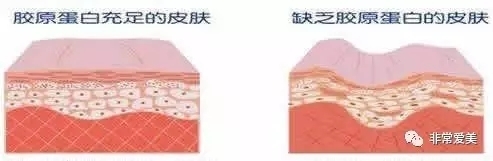 随着年龄的增长，胶原蛋白会流逝