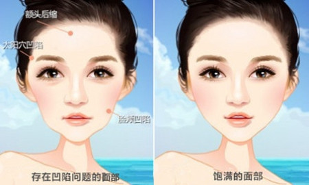 面部凹陷与饱满对比