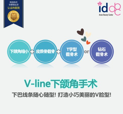 ID整形医院钻石vline下颌角手术