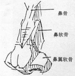 鼻头缩小