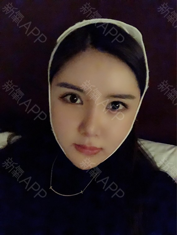 磨骨四件套术后第六天.jpg