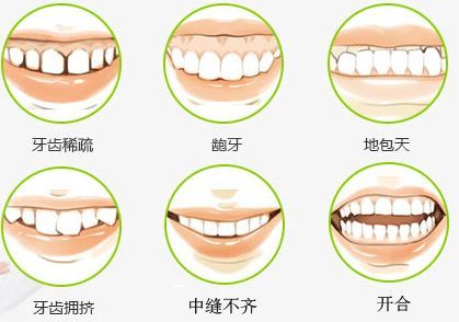 牙齿口腔问题种类