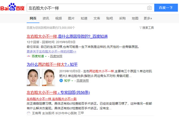 面部不对称怎么办.jpg
