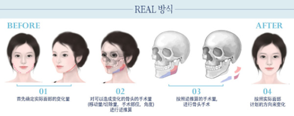 韩国菲斯莱茵REAL(缩小量逆推算分析方式）.jpg